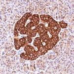 ICA1 Polyclonal Antibody