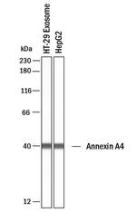 Annexin A4 Polyclonal Antibody