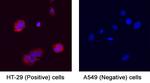 ITGB6 Polyclonal Antibody
