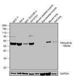 PRKAR1B Antibody in Western Blot (WB)