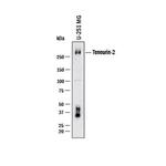 TENM2 Antibody in Western Blot (WB)