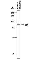 5T4 Antibody in Western Blot (WB)