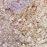 Ninjurin 2 Polyclonal Antibody