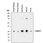 Ninjurin 2 Antibody in Western Blot (WB)