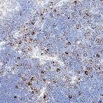 Limitin Polyclonal Antibody