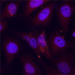 NUP85 Polyclonal Antibody