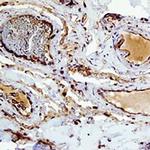 Eotaxin 3 Polyclonal Antibody