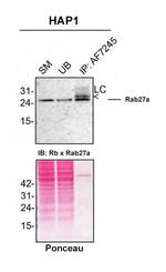 RAB27A Polyclonal Antibody