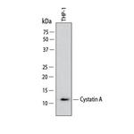 Cystatin A Polyclonal Antibody
