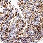 Galectin 4 Antibody in Immunohistochemistry (Paraffin) (IHC (P))