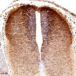 IGFBPL1 Polyclonal Antibody