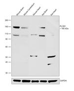 PLCB1 Polyclonal Antibody