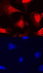 FUT11 Polyclonal Antibody