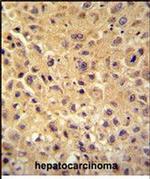 WBSCR27 Antibody in Immunohistochemistry (Paraffin) (IHC (P))