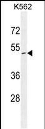 ZNF517 Antibody in Western Blot (WB)
