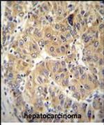 NARS Antibody in Immunohistochemistry (Paraffin) (IHC (P))