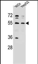 NARS Antibody in Western Blot (WB)