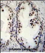 DDX27 Antibody in Immunohistochemistry (Paraffin) (IHC (P))