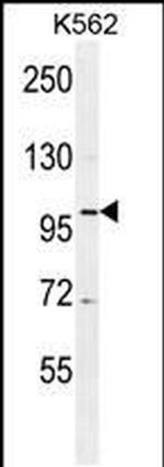 DDX27 Antibody in Western Blot (WB)