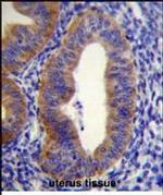 FGD6 Antibody in Immunohistochemistry (Paraffin) (IHC (P))