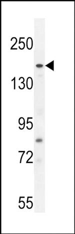 FGD6 Antibody in Western Blot (WB)