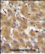 HPR Antibody in Immunohistochemistry (Paraffin) (IHC (P))