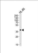 HPR Antibody in Western Blot (WB)