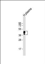 HPR Antibody in Western Blot (WB)