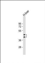 HPR Antibody in Western Blot (WB)