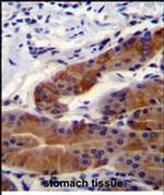 DFNB31 Antibody in Immunohistochemistry (Paraffin) (IHC (P))