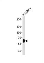 DFNB31 Antibody in Western Blot (WB)
