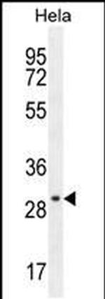 EMG1 Antibody in Western Blot (WB)