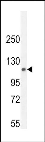 PHF12 Antibody in Western Blot (WB)
