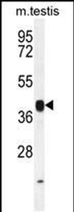 INHBB Antibody in Western Blot (WB)
