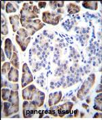 UROC1 Antibody in Immunohistochemistry (Paraffin) (IHC (P))