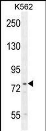 UROC1 Antibody in Western Blot (WB)