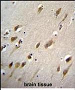 HARBI1 Antibody in Immunohistochemistry (Paraffin) (IHC (P))