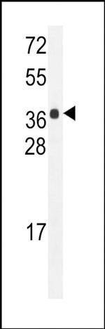 HARBI1 Antibody in Western Blot (WB)