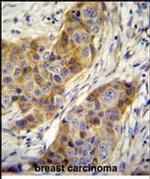 ANKRD39 Antibody in Immunohistochemistry (Paraffin) (IHC (P))