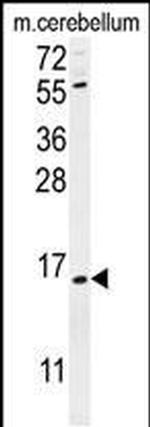 ANKRD39 Antibody in Western Blot (WB)