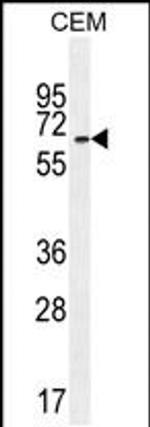 UNCX Antibody in Western Blot (WB)