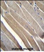 TRMT2B Antibody in Immunohistochemistry (Paraffin) (IHC (P))