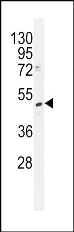 TRMT2B Antibody in Western Blot (WB)