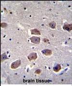 NAA30 Antibody in Immunohistochemistry (Paraffin) (IHC (P))