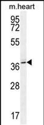 NAA30 Antibody in Western Blot (WB)