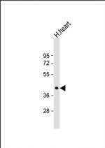 NAA30 Antibody in Western Blot (WB)