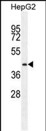PRRT1 Antibody in Western Blot (WB)