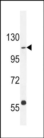 GIGYF1 Antibody in Western Blot (WB)