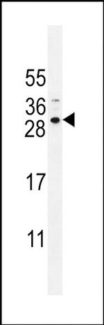 SPACA5 Antibody in Western Blot (WB)