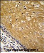 NUDT22 Antibody in Immunohistochemistry (Paraffin) (IHC (P))